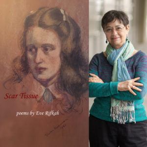 Scar Tissue by Eve Rifkah